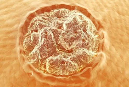 Mole Removal Advanced Skin Treatments